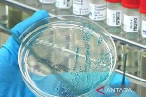 Australia catat kasus pertama flu burung pada mamalia